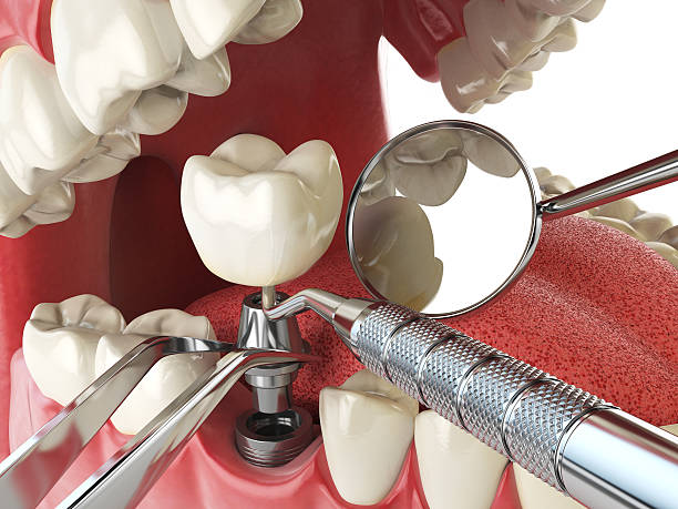 Best Emergency Treatment for Toothache in Splendora, TX